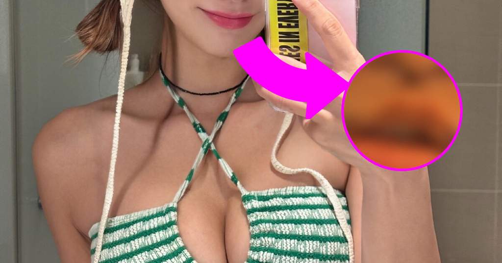 Perbandingan foto sebelum dan sesudah operasi pemotongan philtrum dan sudut bibir komedian Korea Maeng Seung Ji yang diunggah di Instagram.